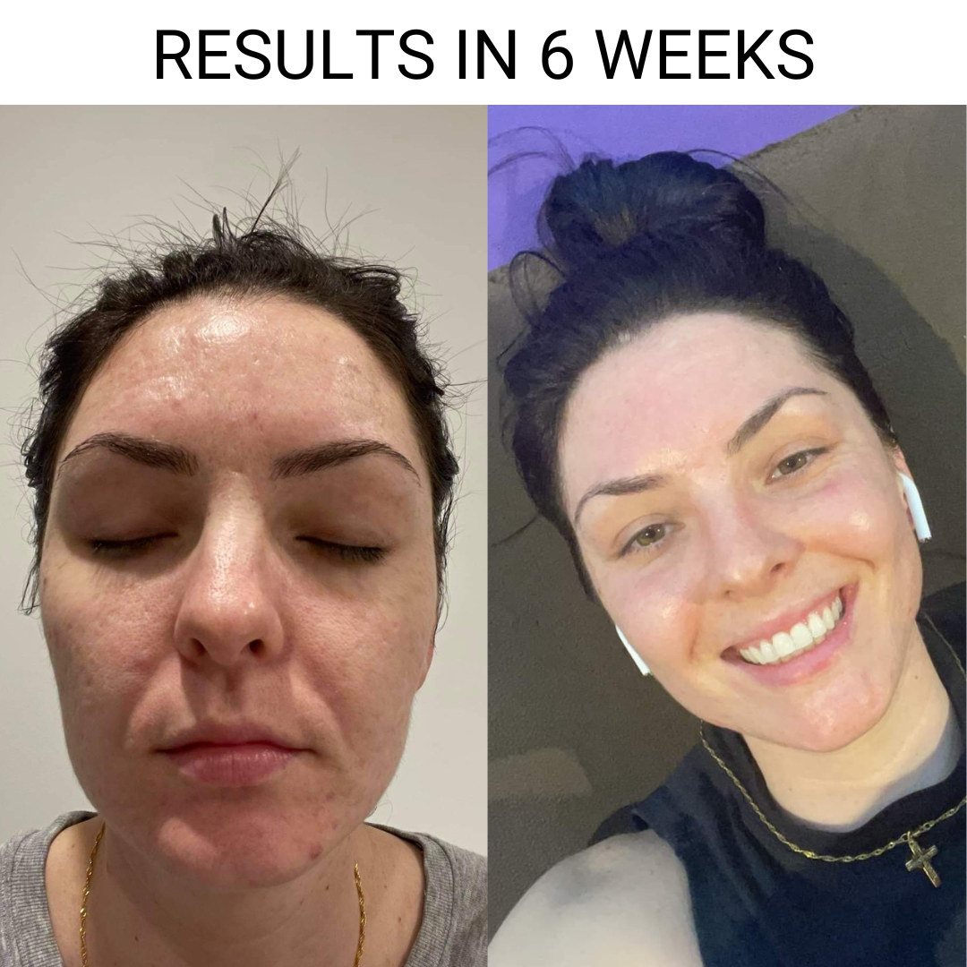 Clarifying Gel Cleanser